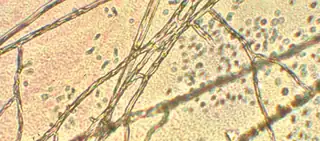 ScienceKlubben: The Secret World of Fungi