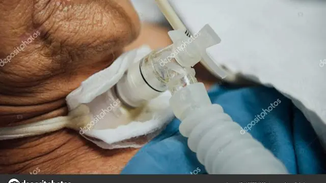 Acute Procedures · SDU SUND, Odense